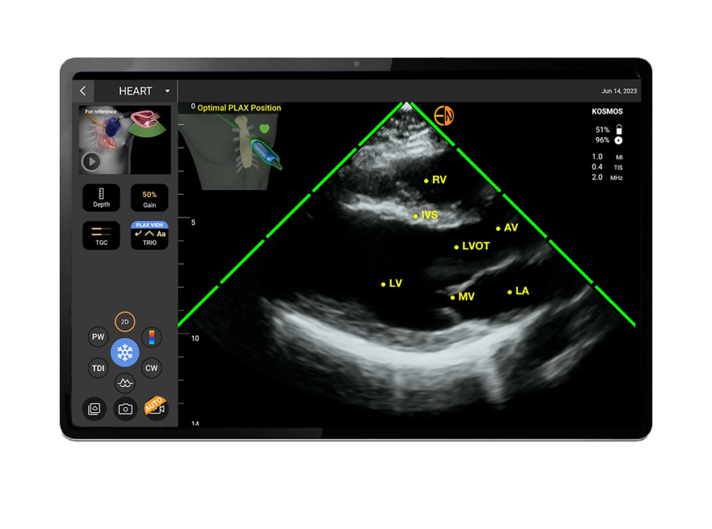 Kosmos cutting-edge AI and fully featured capabilities on select Android tablets.