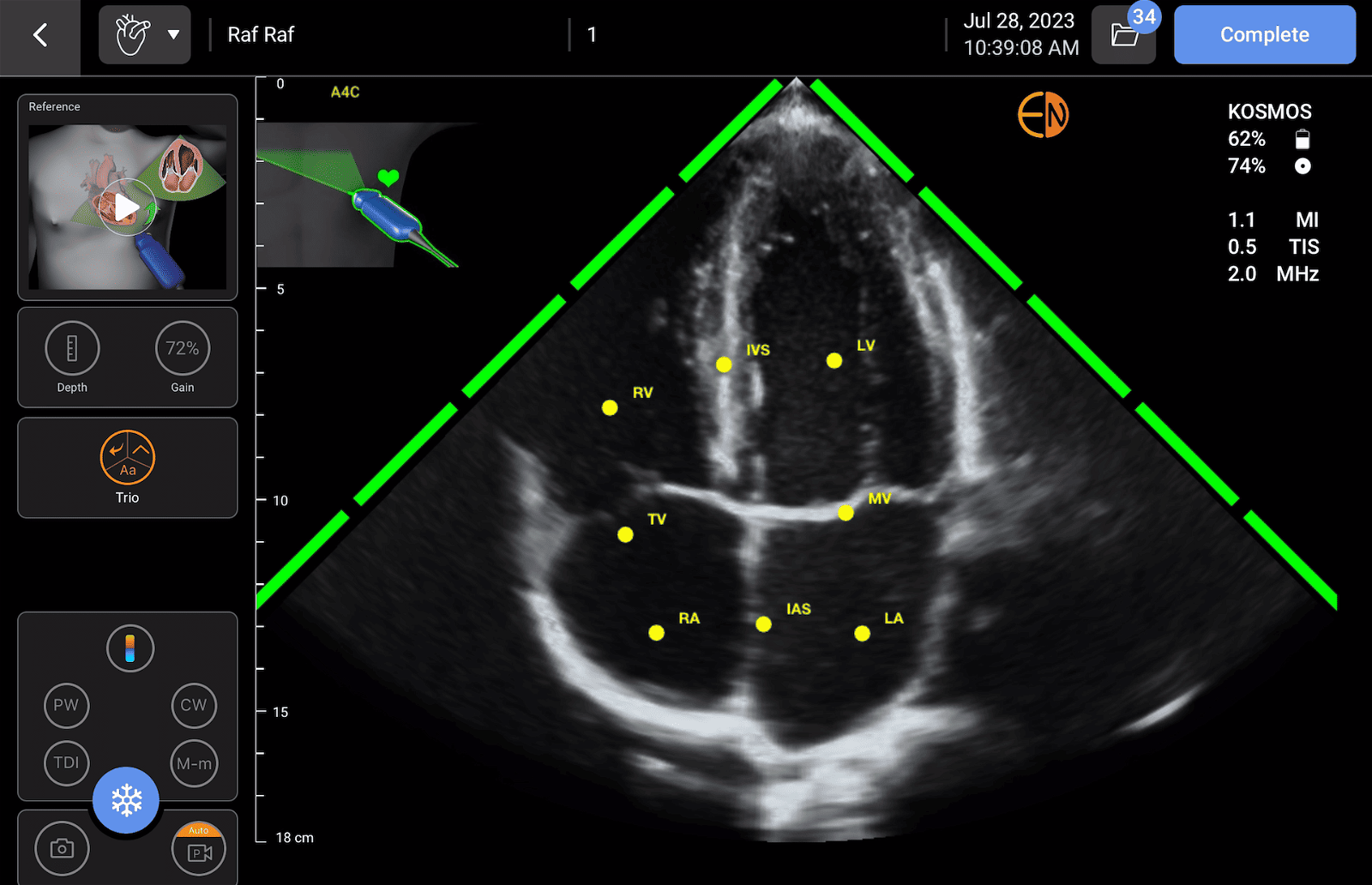 Kosmos Trio- automated guidance, grading, and labeling of cardiac anatomy