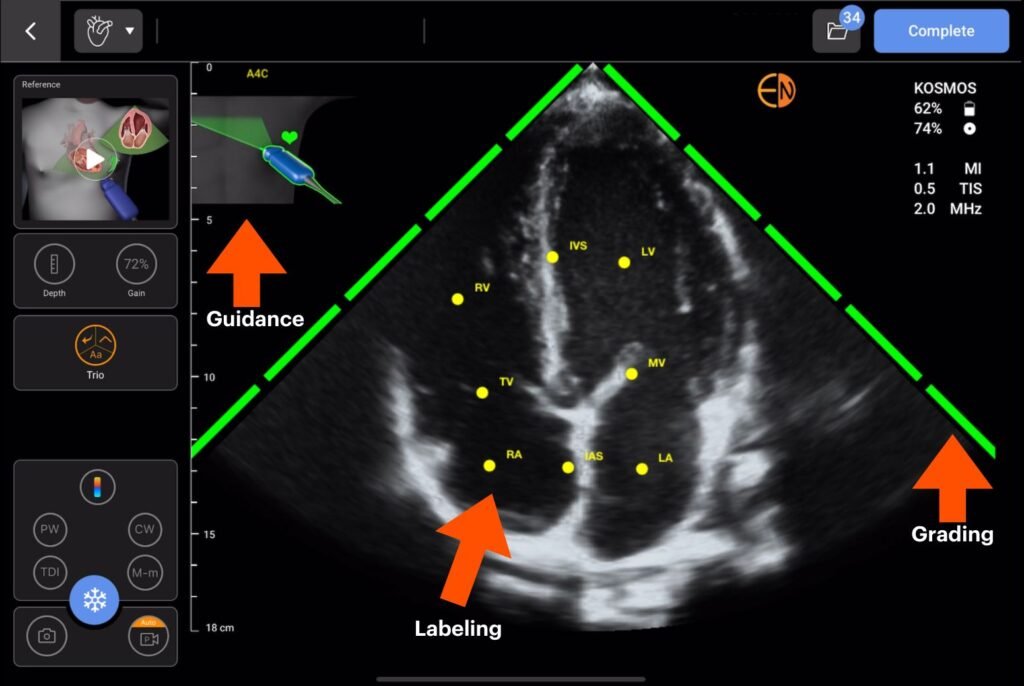 Trio: AI-driven guidance, grading, and labeling of cardiac anatomy