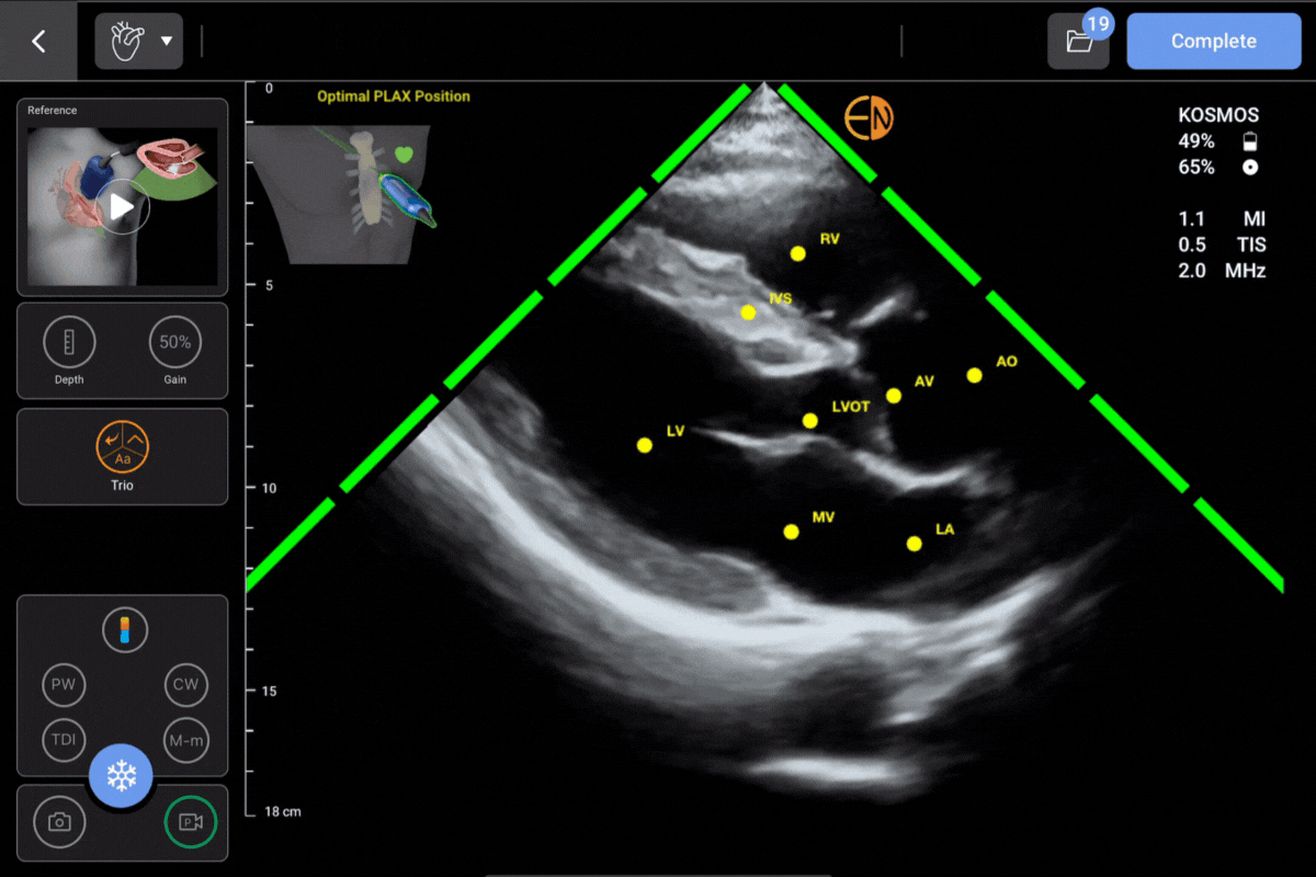 Kosmos Trio: AI-driven guidance, grading, and labeling of cardiac anatomy on Apple iOS and Android tablets