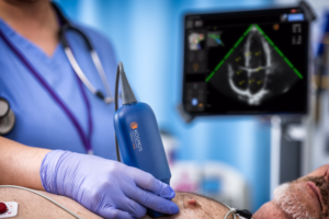 EchoNous is pioneering a new POCUS era with Kosmos—a fusion of cart-based quality, handheld affordability, and AI-enhanced efficiency—the complete package.