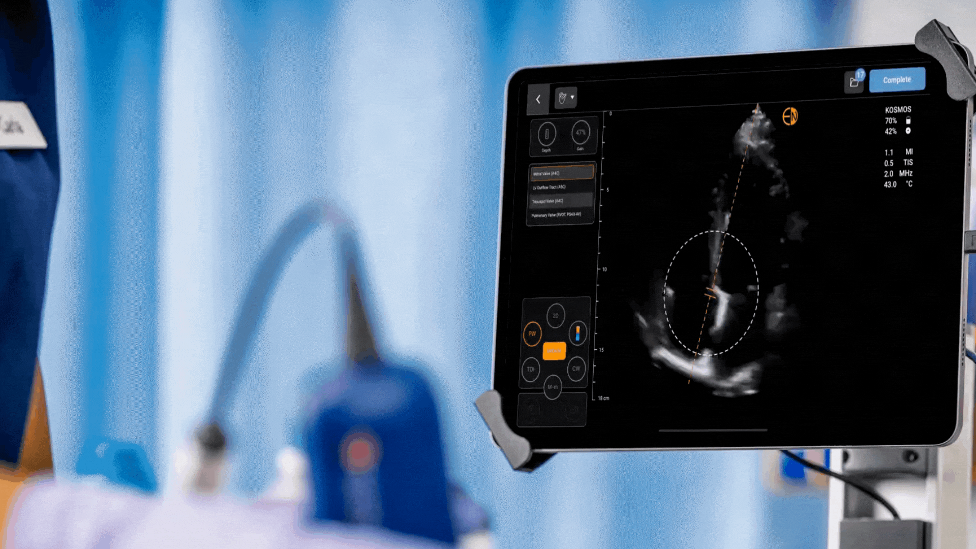 Auto Doppler automatically places the sample gate in the optimal location for the cardiac valve of interest, drastically simplifying valve interrogation for POCUS users.