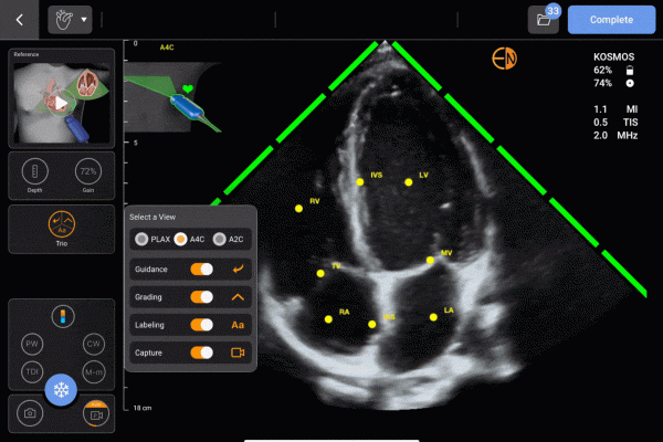 Kosmos Trio for Apple iOS- Guidance, Grading, and Labeling of the cardiac anatomy